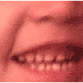 Roama Bapafims Mouth Closer & Lower AI Voice