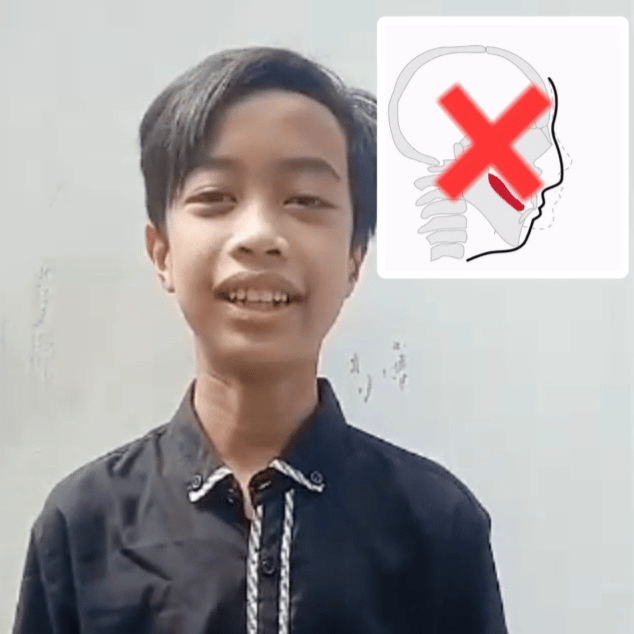 Voice AI Voice