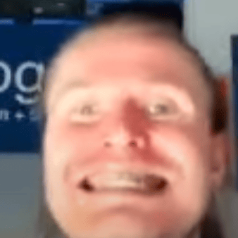 Steino AI Voice