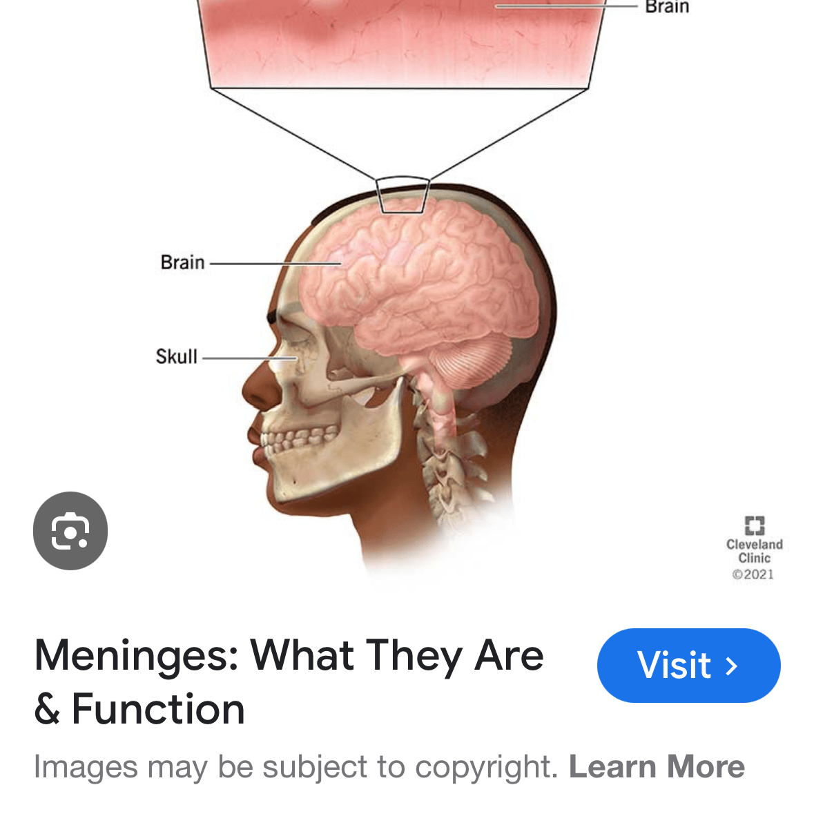Voice AI Voice