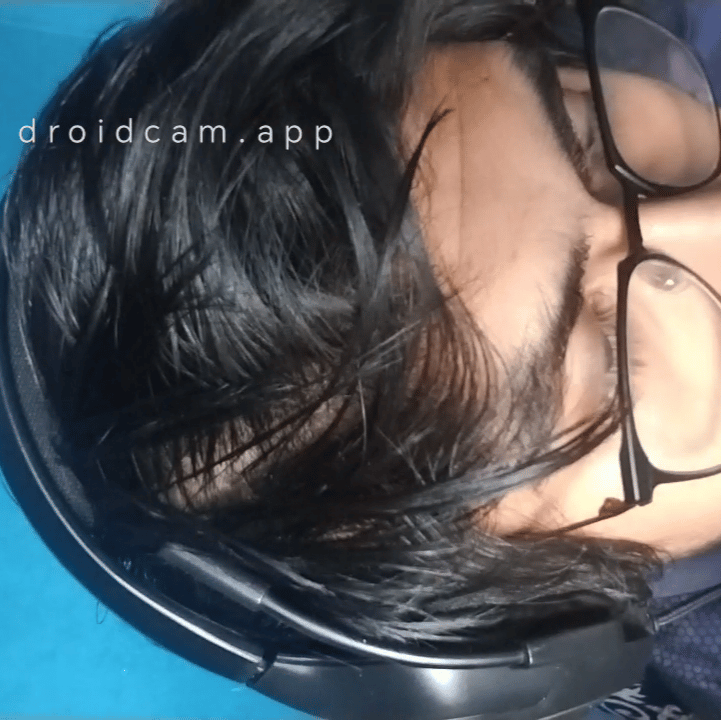 Voice AI Voice
