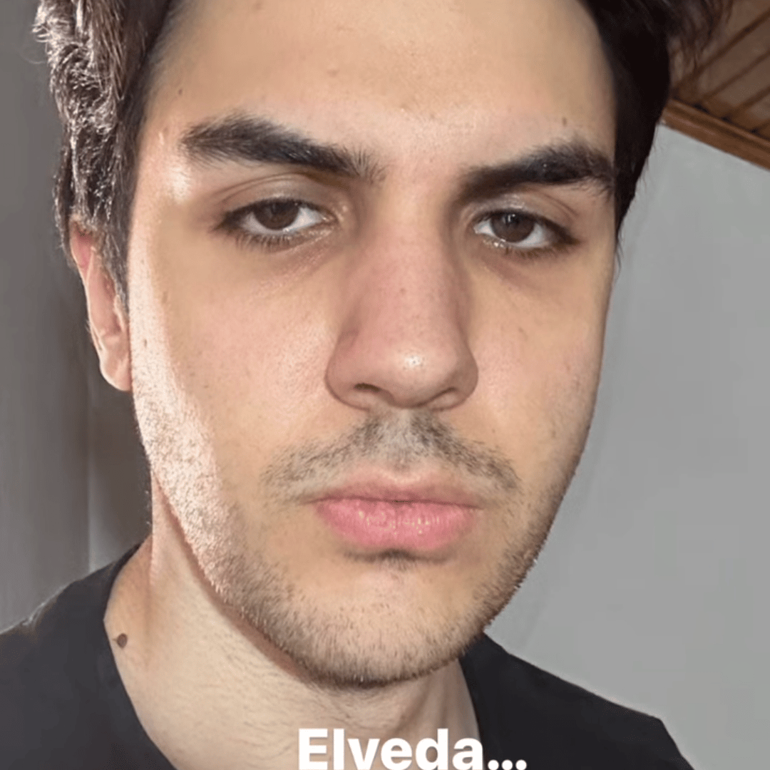 Voice AI Voice