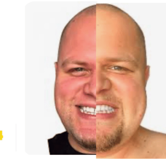 Voice AI Voice