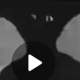 Voice AI Voice