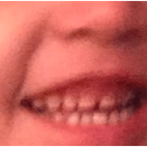 Roama Bapafims Mouth Closer & Lower AI Voice